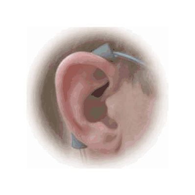 Adult w/7' Kink Resistant Tubing and Earmates attached