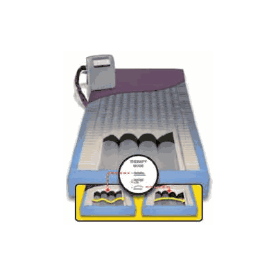 Alternating Pressure Mattress Pressureguard