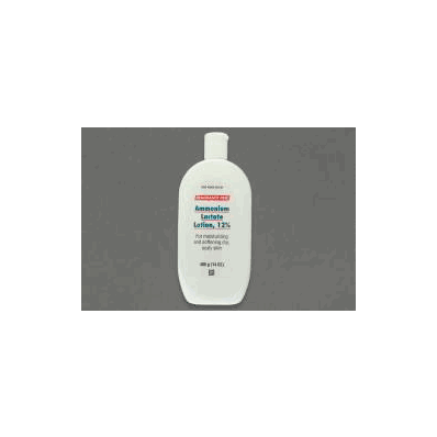 Ammonium Lactate Skin Lotion, 14 oz. Lotion