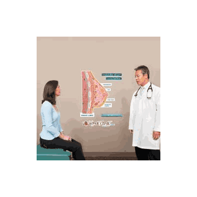 Anatomical Chart Breast Lumps (Labeled) - Cha