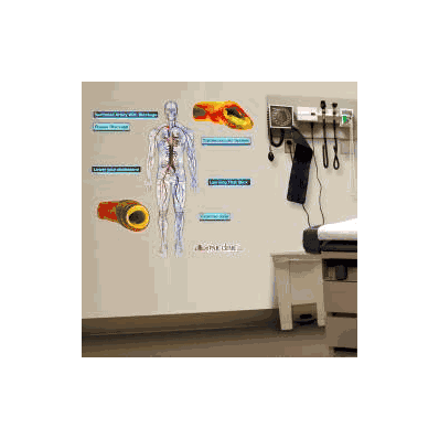 Anatomical Chart Cardiovascular System - Char