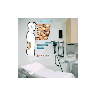Anatomical Chart Compression Fracture - Chart