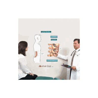 Anatomical Chart Compression Fracture (Labele