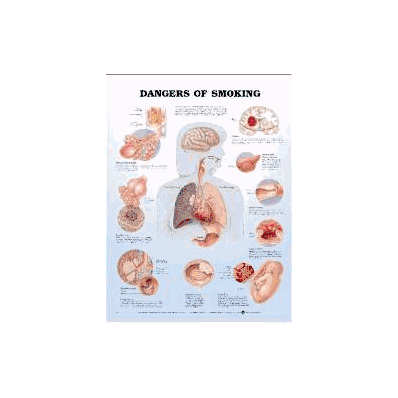 Anatomical Chart Dangers Of Smoking - Chart,