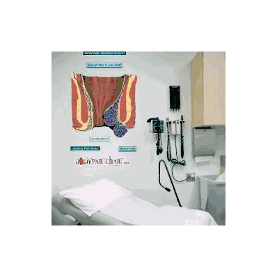 Anatomical Chart Hemorrhoids - Chart, Hemorrh