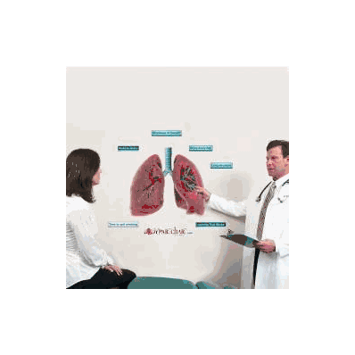Anatomical Chart Lungs Cross Section - Chart,