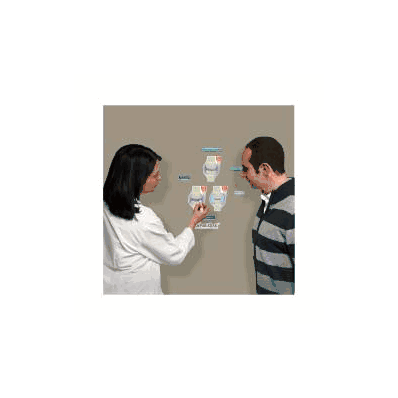 Anatomical Chart Rheumatoid Arthritis - Chart