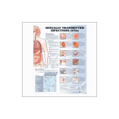 Anatomical Chart Sexually Transmitted Infecti