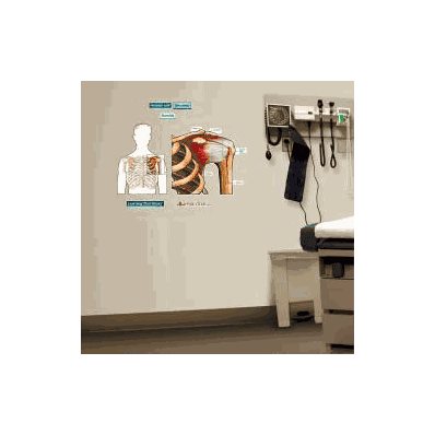 Anatomical Chart Shoulder (Labeled) - Chart,