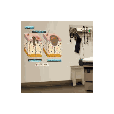 Anatomical Chart Skin Cancer - Chart, Skin Ca