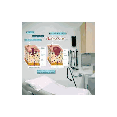 Anatomical Chart Skin Cancer (Labeled) - Char