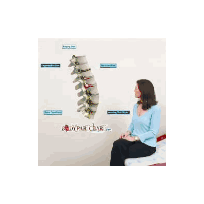 Anatomical Chart Spine Conditions - Chart, Sp