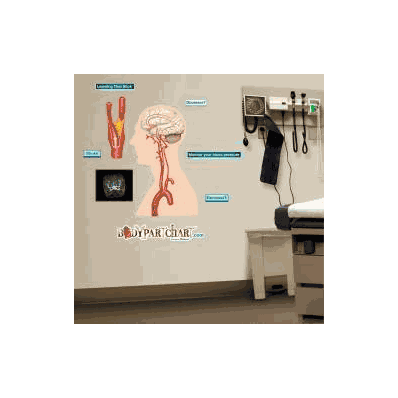 Anatomical Chart Stroke - Chart, Stroke Med 2
