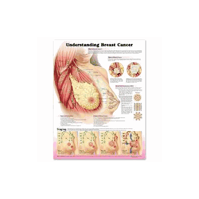 Anatomical Chart Understanding Breast Cancer