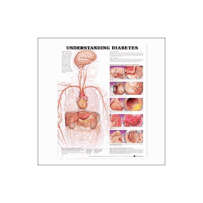 Anatomical Chart Understanding Diabetes - Cha