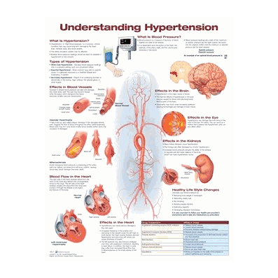 Anatomical Chart Understanding Hypertension, New Upgraded Version #2