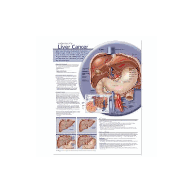 Anatomical Chart Understanding Liver Cancer -