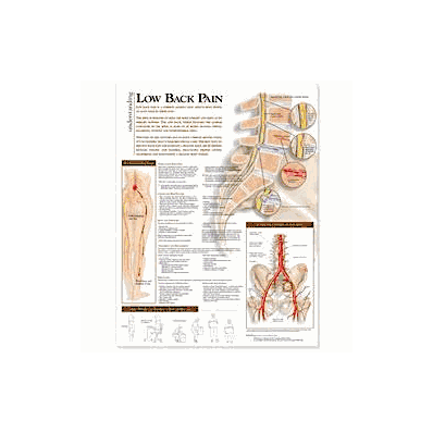 Anatomical Chart Understanding Low Back Pain