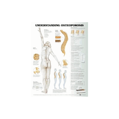 Anatomical Chart Understanding Osteoporosis -