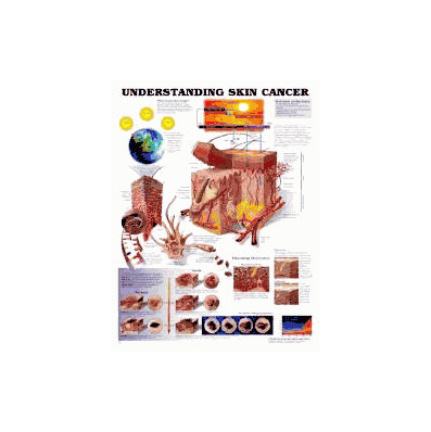 Anatomical Chart Understanding Skin Cancer -