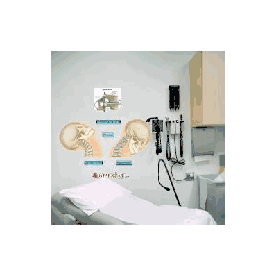 Anatomical Chart Whiplash - Chart, Whiplash M