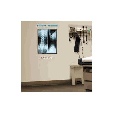 Anatomical Chart X-ray Of Lumbar Spine - Char