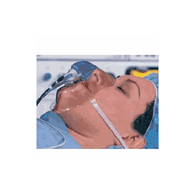 Anesthesia Face Mask - Mask, Oxygen Adlt (25/