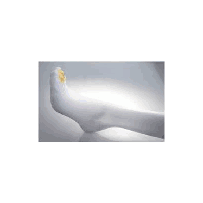 Ultra C.A.R.E Anti-embolism Stockings Knee-h