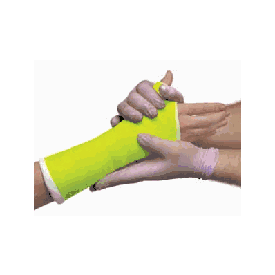 Bandage, 3", Conform Neon Yellow