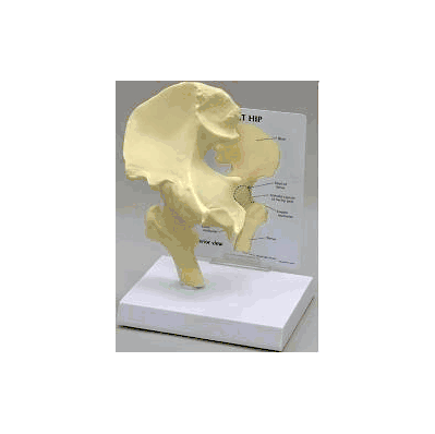 Basic Hip Model - Model, Basic Hip Rigid W/Pa