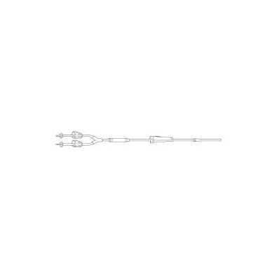 Bladder Irrigation Set, 81" Y-Type with 0.195"