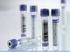 Vacuette K3 Edta Additive Blood Collection Tubes 13x75 mm, 2 mL Lavender/WHITE Ring Cap by Greiner Bio-One 1200/cs, #454222 <br><br><font color="red"><b>BACK TO THE PRODUCT TABLE, <a href="http://www.aaawholesalecompany.com/clinical-laboratory-laboratory-glassware-and-plasticware-vacuette-k3-edta-blood-collection-tubes-by-.html">CLICK HERE</a></b></font>