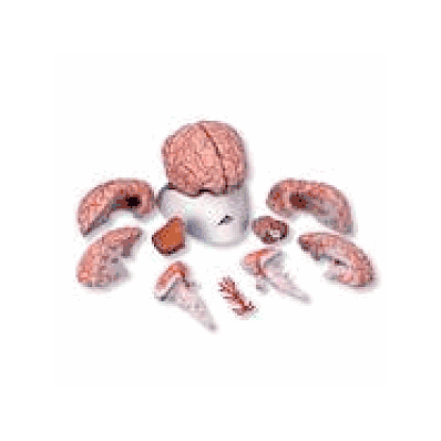 Brain With Arteries, 9 Part