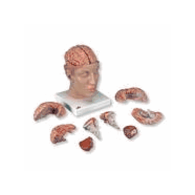 Brain with Arteries on Base of Head, 8 part