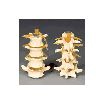 Budget Lumbar Set - Lumbar Set, Budget 4part