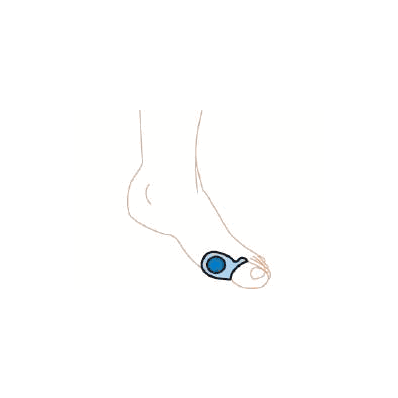 Bunion Gel Shield Small - Bunion Shield, Gel