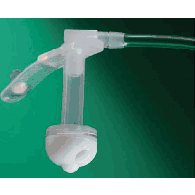 Button Decompression Tube, 18 Fr., 1.7 cm