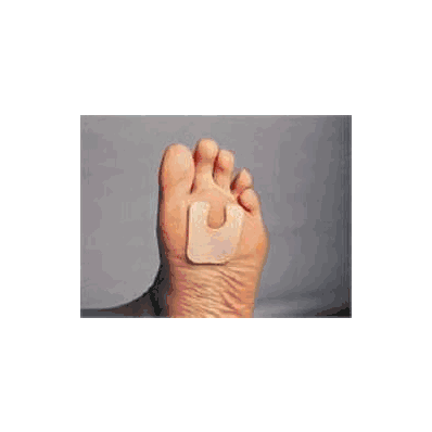 Callus Protector Cushion - Callus Protector,
