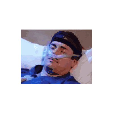 Cannula, Cpap Nasal F/Nasal Aire Ii Xsm - -