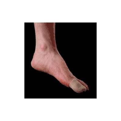 Cap, Digital Sm/Med (6/Pk) - - Silipos