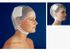 CareFix Elastic Dressing, Yellow, Small, Head & Neck Surgery, Precut Retention Dressing, sold as 100/Case by Key Surgical brand, Tytex 017050-01.01.057 <br><br><font color="red"><b>BACK TO THE PRODUCT TABLE, <a href="https://www.aaawholesalecompany.com/tytex-wound-care-carefix-elastic-dressing-by-key-surgical-brand.html">CLICK HERE</a></b></font>