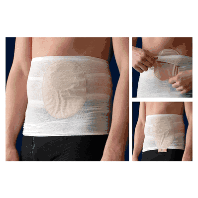 CareFix StomaSafe Classic,With different siz