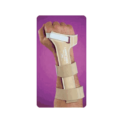 Carpallock Lg Left