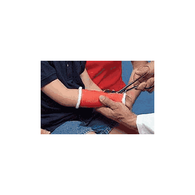 Cast Tape Delta-cast 1 Inch X 6 Foot Polyest
