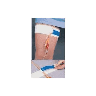 Catheter Holder Hook And Loop Closure - Strap