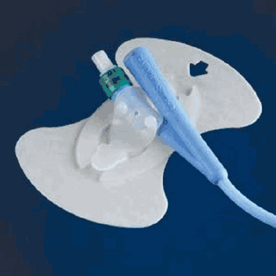 Catheter Kit, Foley Secure Anchor, White