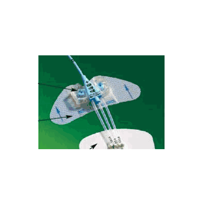 Central Venous Catheter Stabilization Device
