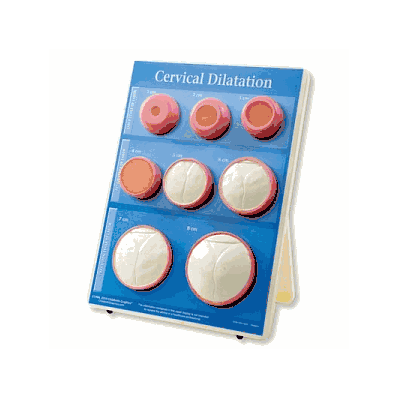 Cervical Dilation Easel Display