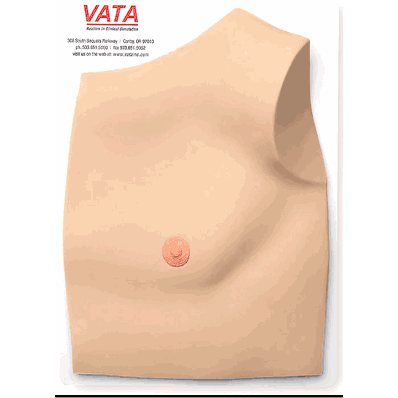 Outer Tissue Flap