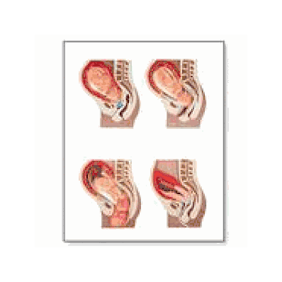 Childbirth Process Chart with wooden rods
